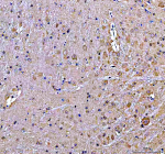 Immunohistochemical staining of SOS1 using anti-SOS1 antibody. SOS1 was detected in a paraffin-embedded section of rat cerebellum tissue. Heat mediated antigen retrieval was performed in EDTA buffer (pH 8.0, epitope retrieval solution). The tissue section was blocked with 10% goat serum. The tissue section was then incubated with 2 ug/ml rabbit anti-SOS1 antibody overnight at 4oC. Peroxidase Conjugated Goat Anti-rabbit IgG was used as secondary antibody and incubated for 30 minutes at 37oC. The tissue section was developed using an HRP secondary and DAB substrate.