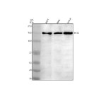 Western blot analysis of PHF8 using anti-PHF8 antibody. Electrophoresis was performed on a 8% SDS-PAGE gel at 80V (Stacking gel) / 120V (Resolving gel) for 2 hours. Lane 1: human whole cell lysates, Lane 2: human Hela whole cell lysates, Lane 3: human Jurkat whole cell lysates. After electrophoresis, proteins were transferred to a nitrocellulose membrane at 150 mA for 50-90 minutes. Blocked the membrane with 5% non-fat milk/TBS for 1.5 hour at RT. The membrane was incubated with rabbit anti-PHF8 antibody at 0.5 ug/ml overnight at 4oC, then washed with TBS-0.1%Tween 3 times with 5 minutes each and probed with a goat anti-rabbit IgG-HRP secondary antibody at a dilution of 1:5000 for 1.5 hour at RT. The signal was developed using an ECL Plus Western Blotting Substrate. Western blot analysis of cell lysates probed with anti-PHF8 shows a major band at ~140 kDa, higher than the predicted ~118 kDa, consistent with the known phosphorylated form of PHF8 that migrates more slowly on SDS-PAGE.