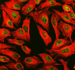 Immunofluorescent staining of PHF8 using anti-PHF8 antibody (green) and anti-Beta Tubulin antibody (red). PHF8 was detected in an immunocytochemical section of HELA cells. Enzyme antigen retrieval was performed using IHC enzyme antigen retrieval reagent for 15 mins. The cells were blocked with 10% goat serum. And then incubated with 5 ug/ml rabbit anti-PHF8 antibody and mouse anti-Beta Tubulin antibody overnight at 4oC. DyLight 488 Conjugated Goat Anti-Rabbit IgG and Cy3 Conjugated Goat Anti-Mouse IgG were used as secondary antibody at 1:500 dilution and incubated for 30 minutes at 37oC. Visualize using a fluorescence microscope and filter sets appropriate for the label used.