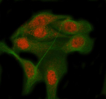 Immunofluorescent staining of RBM12B using anti-RBM12B antibody (red) and anti-Beta Tubulin antibody (green). RBM12B was detected in immunocytochemical section of HELA cell. Enzyme antigen retrieval was performed using IHC enzyme antigen retrieval reagent for 15 mins. The cells were blocked with 10% goat serum. And then incubated with 5 ug/ml rabbit anti-RBM12B antibody and mouse anti-Beta Tubulin antibody overnight at 4oC. Cy3 Conjugated Goat Anti-Rabbit IgG and FITC Conjugated Goat Anti-Mouse IgG were used as secondary antibody at 1:500 dilution and incubated for 30 minutes at 37oC. Visualize using a fluorescence microscope and filter sets appropriate for the label used.