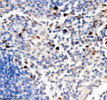 Immunohistochemical staining of TCIRG1 using anti-TCIRG1 antibody. TCIRG1 was detected in a paraffin-embedded section of human tonsil tissue. Heat mediated antigen retrieval was performed in EDTA buffer (pH 8.0, epitope retrieval solution). The tissue section was blocked with 10% goat serum. The tissue section was then incubated with 2 ug/ml rabbit anti-TCIRG1 antibody overnight at 4oC. Peroxidase Conjugated Goat Anti-rabbit IgG was used as secondary antibody and incubated for 30 minutes at 37oC. The tissue section was developed using an HRP secondary and DAB substrate. Tonsil section shows scattered cytoplasmic/vesicular staining in macrophages and histiocytes within the germinal centers, consistent with TCIRG1 expression in antigen-presenting phagocytes.