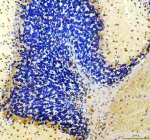 Immunohistochemical staining of TIGAR using anti-TIGAR antibody. TIGAR was detected in a paraffin-embedded section of mouse cerebellum tissue. Heat mediated antigen retrieval was performed in EDTA buffer (pH 8.0, epitope retrieval solution). The tissue section was blocked with 10% goat serum. The tissue section was then incubated with 2 ug/ml rabbit anti-TIGAR antibody overnight at 4oC. Peroxidase Conjugated Goat Anti-rabbit IgG was used as secondary antibody and incubated for 30 minutes at 37oC. The tissue section was developed using an HRP secondary and DAB substrate.