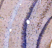 Immunohistochemical staining of TIGAR using anti-TIGAR antibody. TIGAR was detected in a paraffin-embedded section of rat brain tissue. Heat mediated antigen retrieval was performed in EDTA buffer (pH 8.0, epitope retrieval solution). The tissue section was blocked with 10% goat serum. The tissue section was then incubated with 2 ug/ml rabbit anti-TIGAR antibody overnight at 4oC. Peroxidase Conjugated Goat Anti-rabbit IgG was used as secondary antibody and incubated for 30 minutes at 37oC. The tissue section was developed using an HRP secondary and DAB substrate.