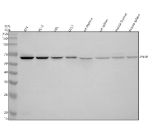 Western blot analysis of PNKP using anti-PNKP antibody. Electrophoresis was performed on a 10% SDS-PAGE gel at 80V (Stacking gel) / 120V (Resolving gel) for 2 hours. Lane 1: human RT4 whole cell lysates, Lane 2: human PC-3 whole cell lysates, Lane 3: human HEL whole cell lysates, Lane 4: human U251 whole cell lysates, Lane 5: rat thymus tissue lysates, Lane 6: rat spleen tissue lysates, Lane 7: mouse thymus tissue lysates, Lane 8: mouse spleen tissue lysates. After electrophoresis, proteins were transferred to a nitrocellulose membrane at 150 mA for 50-90 minutes. Blocked the membrane with 5% non-fat milk/TBS for 1.5 hour at RT. The membrane was incubated with rabbit anti-PNKP antibody at 0.5 ug/ml overnight at 4oC, then washed with TBS-0.1%Tween 3 times with 5 minutes each and probed with a goat anti-rabbit IgG-HRP secondary antibody at a dilution of 1:5000 for 1.5 hour at RT. The signal was developed using an ECL Plus Western Blotting Substrate. A specific band was detected for PNKP at approximately 57 kDa. The expected molecular weight of PNKP is ~57 kDa.