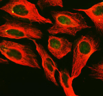 Immunofluorescent staining of PNKP using anti-PNKP antibody and anti-Beta Tubulin antibody. PNKP was detected in an immunocytochemical section of U2OS cells. Enzyme antigen retrieval was performed using IHC enzyme antigen retrieval reagent for 15 mins. The cells were blocked with 10% goat serum. And then incubated with 5 ug/ml rabbit anti-PNKP antibody and mouse anti-Beta Tubulin antibody overnight at 4oC. DyLight 488 Conjugated Goat Anti-Rabbit IgG and Cy3 Conjugated Goat Anti-Mouse IgG were used as secondary antibody at 1:500 dilution and incubated for 30 minutes at 37oC. Visualize using a fluorescence microscope and filter sets appropriate for the label used.
