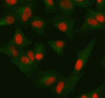 Immunofluorescent staining of ORC2 using anti-ORC2 antibody (red) and anti-Beta Tubulin antibody (green). ORC2 was detected in immunocytochemical section of cell. Enzyme antigen retrieval was performed using IHC enzyme antigen retrieval reagent for 15 mins. The cells were blocked with 10% goat serum. And then incubated with 5 ug/ml rabbit anti-ORC2 antibody and mouse anti-Beta Tubulin antibody overnight at 4oC. Cy3 Conjugated Goat Anti-Rabbit IgG and FITC Conjugated Goat Anti-Mouse IgG were used as secondary antibody at 1:500 dilution and incubated for 30 minutes at 37oC. Visualize using a fluorescence microscope and filter sets appropriate for the label used.