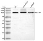 Western blot analysis of ATP1A4 using anti-ATP1A4 antibody. Lane 1: rat C6 whole cell lysates, Lane 2: mouse testis tissue lysates, Lane 3: mouse Raw264.7 whole cell lysates. After electrophoresis, proteins were transferred to a nitrocellulose membrane at 150 mA for 50-90 minutes. Blocked the membrane with 5% non-fat milk/TBS for 1.5 hour at RT. The membrane was incubated with rabbit anti-ATP1A4 antibody at 0.5 ug/ml overnight at 4oC, then washed with TBS-0.1%Tween 3 times with 5 minutes each and probed with a goat anti-rabbit IgG-HRP secondary antibody at a dilution of 1:5000 for 1.5 hour at RT. The signal was developed using enhanced chemiluminescent. Western blot probed with anti-ATP1A4 shows a dominant band at ~100 kDa, slightly below the predicted ~114 kDa, consistent with the known anomalous migration of the Na+/K+-ATPase alpha 4 subunit due to its transmembrane structure and partial deglycosylation.