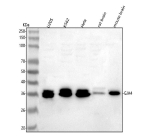 Western blot analysis of GJA4 using anti-GJA4 antibody. Lane 1: human U20S whole cell lysates, Lane 2: human K562 whole cell lysates, Lane 3: human Hela whole cell lysates, Lane 4: rat brain tissue lysates, Lane 5: mouse brain tissue lysates. After electrophoresis, proteins were transferred to a nitrocellulose membrane at 150 mA for 50-90 minutes. Blocked the membrane with 5% non-fat milk/TBS for 1.5 hour at RT. The membrane was incubated with rabbit anti-GJA4 antibody at 0.5 ug/ml overnight at 4oC, then washed with TBS-0.1%Tween 3 times with 5 minutes each and probed with a goat anti-rabbit IgG-HRP secondary antibody at a dilution of 1:5000 for 1.5 hour at RT. The signal was developed using enhanced chemiluminescent. Western blot probed with anti-GJA4 shows a characteristic doublet near ~37 kDa, consistent with phosphorylated and non-phosphorylated forms of Connexin 37.