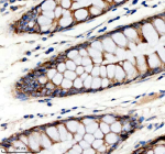 Immunohistochemical staining of RB1CC1 using anti-RB1CC1 antibody. RB1CC1 was detected in a paraffin-embedded section of human colon tissue. Heat mediated antigen retrieval was performed in EDTA buffer (pH 8.0, epitope retrieval solution). The tissue section was blocked with 10% goat serum. The tissue section was then incubated with 2 ug/ml rabbit anti-RB1CC1 antibody overnight at 4oC. Peroxidase Conjugated Goat Anti-rabbit IgG was used as secondary antibody and incubated for 30 minutes at 37oC. The tissue section was developed using an HRP secondary and DAB substrate.
