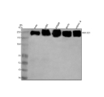Western blot analysis of RB1CC1 using anti-RB1CC1 antibody. Electrophoresis was performed on a 12% SDS-PAGE gel at 80V (Stacking gel) / 120V (Resolving gel) for 2 hours. Lane 1: human Hela whole cell lysates, Lane 2: human U2OS whole cell lysates, Lane 3: human SW620 whole cell lysates, Lane 4: rat RH-35 whole cell lysates, Lane 5: mouse Hepa1-6 whole cell lysates. After electrophoresis, proteins were transferred to a nitrocellulose membrane at 150 mA for 50-90 minutes. Blocked the membrane with 5% non-fat milk/TBS for 1.5 hour at RT. The membrane was incubated with rabbit anti-RB1CC1 antibody at 1:1000 overnight at 4oC, then washed with TBS-0.1%Tween 3 times with 5 minutes each and probed with a goat anti-rabbit IgG-HRP secondary antibody at a dilution of 1:5000 for 1.5 hour at RT. The signal was developed using an ECL Plus Western Blotting Substrate. Western blot probed with anti-RB1CC1 (FIP200) shows a strong band at ~230 kDa, higher than the predicted ~183 kDa, consistent with the phosphorylated, slow-migrating form of FIP200 commonly observed on SDS-PAGE.