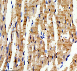 Immunohistochemical staining of RB1CC1 using anti-RB1CC1 antibody. RB1CC1 was detected in a paraffin-embedded section of mouse heart tissue. Heat mediated antigen retrieval was performed in EDTA buffer (pH 8.0, epitope retrieval solution). The tissue section was blocked with 10% goat serum. The tissue section was then incubated with 2 ug/ml rabbit anti-RB1CC1 antibody overnight at 4oC. Peroxidase Conjugated Goat Anti-rabbit IgG was used as secondary antibody and incubated for 30 minutes at 37oC. The tissue section was developed using an HRP secondary and DAB substrate.