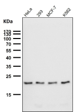 All lanes use the TIMM22 antibody at 1:2000 dilution for 1 hour at room temperature. Predicted molecular weight ~20 kDa.