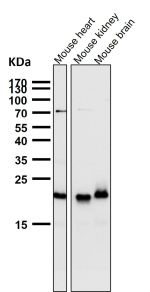 All lanes use the TIMM22 antibody at 1:2000 dilution for 1 hour at room temperature. Predicted molecular weight ~20 kDa.