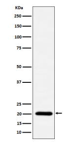Western blot analysis of TIMM22 expression in human A431 cell lysate using TIMM22 antibody. Predicted molecular weight ~20 kDa.