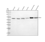 Western blot analysis of RARS2 using anti-RARS2 antibody. Electrophoresis was performed on a 10% SDS-PAGE gel at 80V (Stacking gel) / 120V (Resolving gel) for 2 hours. Lane 1: human SH-SY5Y whole cell lysates, Lane 2: human MCF-7 whole cell lysates, Lane 3: rat kidney tissue lysates, Lane 4: rat brain tissue lysates, Lane 5: mouse kidney tissue lysates, Lane 6: mouse brain tissue lysates. After electrophoresis, proteins were transferred to a nitrocellulose membrane at 150 mA for 50-90 minutes. Blocked the membrane with 5% non-fat milk/TBS for 1.5 hour at RT. The membrane was incubated with rabbit anti-RARS2 antibody at 0.5 ug/ml overnight at 4oC, then washed with TBS-0.1%Tween 3 times with 5 minutes each and probed with a goat anti-rabbit IgG-HRP secondary antibody at a dilution of 1:5000 for 1.5 hour at RT. The signal was developed using an ECL Plus Western Blotting Substrate. A specific band was detected for RARS2 at approximately 66 kDa. The expected molecular weight of RARS2 is ~66 kDa.