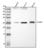 Western blot analysis of STXBP6 using anti-STXBP6 antibody. Lane 1: human HepG2 whole cell lysates, Lane 2: human Caco-2 whole cell lysates, Lane 3: human Ramos whole cell lysates. After electrophoresis, proteins were transferred to a nitrocellulose membrane at 150 mA for 50-90 minutes. Blocked the membrane with 5% non-fat milk/TBS for 1.5 hour at RT. The membrane was incubated with rabbit anti-STXBP6 antibody at 0.5 ug/ml overnight at 4oC, then washed with TBS-0.1%Tween 3 times with 5 minutes each and probed with a goat anti-rabbit IgG-HRP secondary antibody at a dilution of 1:5000 for 1.5 hour at RT. The signal was developed using enhanced chemiluminescent. The expected molecular weight of STXBP6 is ~24 kDa.