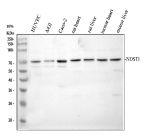 Western blot analysis of NDST1 using anti-NDST1 antibody. Electrophoresis was performed on a 10% SDS-PAGE gel at 80V (Stacking gel) / 120V (Resolving gel) for 2 hours. Lane 1: human HUVEC whole cell lysates. Lane 2: human whole cell lysates. Lane 3: human CACO-2 whole cell lysates. Lane 4: rat heart tissue lysates, Lane 5: rat liver tissue lysates, Lane 6: mouse heart tissue lysates, Lane 7: mouse liver tissue lysates. After electrophoresis, proteins were transferred to a nitrocellulose membrane at 150 mA for 50-90 minutes. Blocked the membrane with 5% non-fat milk/TBS for 1.5 hour at RT. The membrane was incubated with rabbit anti-NDST1 antibody at 0.5 ug/ml overnight at 4oC, then washed with TBS-0.1%Tween 3 times with 5 minutes each and probed with a goat anti-rabbit IgG-HRP secondary antibody at a dilution of 1:5000 for 1.5 hour at RT. The signal is developed using an ECL Plus Western Blotting Substratewith Tanon 5200 system. Western blot probed with anti-NDST1 shows a predominant band at ~70 kDa, lower than the predicted ~101 kDa, consistent with truncated or proteolytically processed forms of the Golgi-localized N-deacetylase/N-sulfotransferase 1.