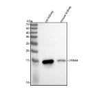 Western blot analysis of LYRM4 using anti-LYRM4 antibody. Lane 1: rat kidney tissue lysates, Lane 2: mouse kidney tissue lysates. After electrophoresis, proteins were transferred to a nitrocellulose membrane at 150 mA for 50-90 minutes. Blocked the membrane with 5% non-fat milk/TBS for 1.5 hour at RT. The membrane was incubated with rabbit anti-LYRM4 antibody at 0.5 ug/ml overnight at 4oC, then washed with TBS-0.1%Tween 3 times with 5 minutes each and probed with a goat anti-rabbit IgG-HRP secondary antibody at a dilution of 1:5000 for 1.5 hour at RT. The signal was developed using enhanced chemiluminescent. Western blot probed with anti-LYRM4 shows a major band at ~11 kDa, lower than the predicted ~15 kDa, consistent with the mature mitochondrial form of LYRM4 lacking its cleaved N-terminal targeting sequence.