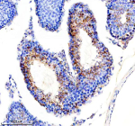 Immunohistochemical staining of NDUF-S2 using anti-NDUF-S2 antibody. NDUF-S2 was detected in a paraffin-embedded section of mouse testis tissue. Heat mediated antigen retrieval was performed in EDTA buffer (pH 8.0, epitope retrieval solution). The tissue section was blocked with 10% goat serum. The tissue section was then incubated with 1:50 rabbit anti-NDUF-S2 antibody overnight at 4oC. Peroxidase Conjugated Goat Anti-rabbit IgG was used as secondary antibody and incubated for 30 minutes at 37oC. The tissue section was developed using an HRP secondary and DAB substrate.