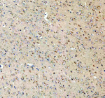 Immunohistochemical staining of SEZ6L2 using anti-SEZ6L2 antibody. SEZ6L2 was detected in a paraffin-embedded section of mouse brain tissue. Heat mediated antigen retrieval was performed in EDTA buffer (pH 8.0, epitope retrieval solution). The tissue section was blocked with 10% goat serum. The tissue section was then incubated with 2 ug/ml rabbit anti-SEZ6L2 antibody overnight at 4oC. Peroxidase Conjugated Goat Anti-rabbit IgG was used as secondary antibody and incubated for 30 minutes at 37oC. The tissue section was developed using an HRP secondary and DAB substrate.