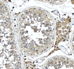 Immunohistochemical staining of SEZ6L2 using anti-SEZ6L2 antibody. SEZ6L2 was detected in a paraffin-embedded section of human testis tissue. Heat mediated antigen retrieval was performed in EDTA buffer (pH 8.0, epitope retrieval solution). The tissue section was blocked with 10% goat serum. The tissue section was then incubated with 2 ug/ml rabbit anti-SEZ6L2 antibody overnight at 4oC. Peroxidase Conjugated Goat Anti-rabbit IgG was used as secondary antibody and incubated for 30 minutes at 37oC. The tissue section was developed using an HRP secondary and DAB substrate.