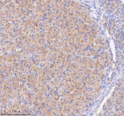 Immunohistochemical staining of SCAMP3 using anti-SCAMP3 antibody. SCAMP3 was detected in a paraffin-embedded section of rat ovary tissue. Heat mediated antigen retrieval was performed in EDTA buffer (pH 8.0, epitope retrieval solution). The tissue section was blocked with 10% goat serum. The tissue section was then incubated with 2 ug/ml rabbit anti-SCAMP3 antibody overnight at 4oC. Peroxidase Conjugated Goat Anti-rabbit IgG was used as secondary antibody and incubated for 30 minutes at 37oC. The tissue section was developed using an HRP secondary and DAB substrate.