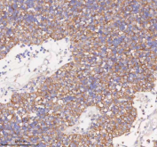 Immunohistochemical staining of SCAMP3 using anti-SCAMP3 antibody. SCAMP3 was detected in a paraffin-embedded section of human spleen tissue. Heat mediated antigen retrieval was performed in EDTA buffer (pH 8.0, epitope retrieval solution). The tissue section was blocked with 10% goat serum. The tissue section was then incubated with 2 ug/ml rabbit anti-SCAMP3 antibody overnight at 4oC. Peroxidase Conjugated Goat Anti-rabbit IgG was used as secondary antibody and incubated for 30 minutes at 37oC. The tissue section was developed using an HRP secondary and DAB substrate.