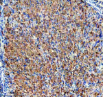 Immunohistochemical staining of EMC1 using anti-EMC1 antibody. EMC1 was detected in a paraffin-embedded section of rat ovary tissue. Heat mediated antigen retrieval was performed in EDTA buffer (pH 8.0, epitope retrieval solution). The tissue section was blocked with 10% goat serum. The tissue section was then incubated with 2 ug/ml rabbit anti-EMC1 antibody overnight at 4oC. Peroxidase Conjugated Goat Anti-rabbit IgG was used as secondary antibody and incubated for 30 minutes at 37oC. The tissue section was developed using an HRP secondary and DAB substrate.