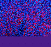 Immunofluorescent staining of EMC1 using anti-EMC1 antibody (red). EMC1 was detected in a paraffin-embedded section of rat ovary tissue. Heat mediated antigen retrieval was performed in EDTA buffer (pH 8.0, epitope retrieval solution). The tissue section was blocked with 10% goat serum. The tissue section was then incubated with 5 ug/ml rabbit anti-EMC1 antibody overnight at 4oC. Cy3 Conjugated Goat Anti-Rabbit IgG was used as secondary antibody at 1:500 dilution and incubated for 30 minutes at 37oC. The section was counterstained with DAPI nuclear stain (blue). Visualize using a fluorescence microscope and filter sets appropriate for the label used.