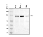 Western blot analysis of ITPKC using anti-ITPKC antibody. Lane 1: human RT4 whole cell lysates, Lane 2: human Caco-2 whole cell lysates, Lane 3: human whole cell lysates. After electrophoresis, proteins were transferred to a nitrocellulose membrane at 150 mA for 50-90 minutes. Blocked the membrane with 5% non-fat milk/TBS for 1.5 hour at RT. The membrane was incubated with rabbit anti-ITPKC antibody at 0.5 ug/ml overnight at 4oC, then washed with TBS-0.1%Tween 3 times with 5 minutes each and probed with a goat anti-rabbit IgG-HRP secondary antibody at a dilution of 1:5000 for 1.5 hour at RT. The signal was developed using enhanced chemiluminescent. Western blot probed with anti-ITPKC shows a dominant band at ~90 kDa, higher than the predicted ~75 kDa, consistent with phosphorylated forms of ITPKC. A faint band near 100 kDa likely represents a hyperphosphorylated or sumoylated variant of the kinase.