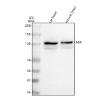 Western blot analysis of ABR using anti-ABR antibody. Lane 1: rat brain tissue lysates, Lane 2: mouse brain tissue lysates. After electrophoresis, proteins were transferred to a nitrocellulose membrane at 150 mA for 50-90 minutes. Blocked the membrane with 5% non-fat milk/TBS for 1.5 hour at RT. The membrane was incubated with rabbit anti-ABR antibody at 0.5 ug/ml overnight at 4oC, then washed with TBS-0.1%Tween 3 times with 5 minutes each and probed with a goat anti-rabbit IgG-HRP secondary antibody at a dilution of 1:5000 for 1.5 hour at RT. The signal was developed using enhanced chemiluminescent. The expected molecular weight of ABR is ~98 kDa.