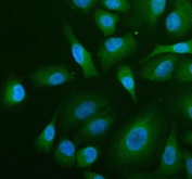 Immunofluorescent staining of ABR using anti-ABR antibody (green). ABR was detected in an immunocytochemical section of human A549 cells. Enzyme antigen retrieval was performed using IHC enzyme antigen retrieval reagent for 15 mins. The cells were blocked with 10% goat serum. And then incubated with 5 ug/ml rabbit anti-ABR antibody overnight at 4oC. DyLight 488 Conjugated Goat Anti-Rabbit IgG was used as secondary antibody at 1:500 dilution and incubated for 30 minutes at 37oC. The section was counterstained with DAPI nuclear stain (blue). Visualize using a fluorescence microscope and filter sets appropriate for the label used.