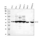 Western blot analysis of MVK using anti-MVK antibody. Electrophoresis was performed on a 10% SDS-PAGE gel at 80V (Stacking gel) / 120V (Resolving gel) for 2 hours. Lane 1: human 293T whole cell lysates, Lane 2: human RT4 whole cell lysates, Lane 3: human HepG2 whole cell lysates, Lane 4: human MCF-7 whole cell lysates, Lane 5: rat RH35 whole cell lysates, Lane 6: mouse HEPA1/6 whole cell lysates. After electrophoresis, proteins were transferred to a nitrocellulose membrane at 150 mA for 50-90 minutes. Blocked the membrane with 5% non-fat milk/TBS for 1.5 hour at RT. The membrane was incubated with rabbit anti-MVK antibody at 0.5 ug/ml overnight at 4oC, then washed with TBS-0.1%Tween 3 times with 5 minutes each and probed with a goat anti-rabbit IgG-HRP secondary antibody at a dilution of 1:5000 for 1.5 hour at RT. The signal is developed using an ECL Plus Western Blotting Substratewith Tanon 5200 system. Western blot probed with anti-MVK shows a strong band at the expected ~42 kDa, with minor higher and lower bands commonly reported and may represent partially degraded fragments, alternative translation products, or nonspecific background.