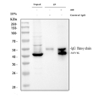 Immunoprecipitating (IP) MVK in HepG2 whole cell lysate. Western blot analysis of MVK using anti-MVK antibody; Lane 1: HepG2 whole cell lysates (30ug); Lane 2: Rabbit control IgG instead of anti-MVK antibody in HepG2 whole cell lysate; Lane 3: anti-MVK antibody (2ug) + HepG2 whole cell lysate (500ug). After electrophoresis, proteins were transferred to a membrane. Then the membrane was incubated with rabbit anti-MVK antibody at a dilution of 0.5 ug/ml and probed with a goat anti-rabbit IgG-HRP secondary antibody. The signal is developed using ECL Plus Western Blotting Substrate. Western blot probed with anti-MVK shows a strong band at the expected ~42 kDa, with minor higher and lower bands commonly reported and may represent partially degraded fragments, alternative translation products, or nonspecific background.