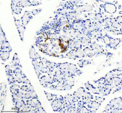 Somatostatin 28 Antibody. Immunohistochemistry analysis of formalin-fixed, paraffin-embedded human colon tissue using a rabbit Somatostatin 28 antibody. Heat-induced antigen retrieval was performed in EDTA buffer at pH 8.0. The section was blocked with goat serum and incubated with primary antibody overnight at 4oC, followed by a peroxidase-conjugated goat anti-rabbit IgG secondary antibody. Cytoplasmic HRP-DAB brown staining is observed in scattered enteroendocrine Somatostatin 28 expression in neuroendocrine cell populations of the gastrointestinal tract.