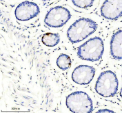 Somatostatin 28 Antibody. Immunohistochemistry analysis of formalin-fixed, paraffin-embedded mouse pancreas tissue using a rabbit Somatostatin 28 antibody. Heat-induced antigen retrieval was performed in EDTA buffer at pH 8.0. The section was blocked with goat serum and incubated with primary antibody overnight at 4oC, followed by a peroxidase-conjugated goat anti-rabbit IgG secondary antibody. Cytoplasmic HRP-DAB brown staining is observed in islet cells within pancreatic tissue, consistent with Somatostatin 28 expression in endocrine cell populations.