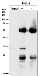 Immunoprecipitation analysis using the ATG10 antibody at 1:50 dilution. Western blot at 1:3000 dilution, the expected molecular weight of ATG10 is ~25 kDa.