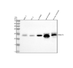 Western blot analysis of RAB27B using anti-RAB27B antibody. Lane 1: human MCF-7 whole cell lysates, Lane 2: human PC-3 whole cell lysates, Lane 3: human U-87MG whole cell lysates, Lane 4: rat stomach tissue lysates, Lane 5: mouse stomach tissue lysates. After electrophoresis, proteins were transferred to a nitrocellulose membrane at 150 mA for 50-90 minutes. Blocked the membrane with 5% non-fat milk/TBS for 1.5 hour at RT. The membrane was incubated with rabbit anti-RAB27B antibody at 0.5 ug/ml overnight at 4oC, then washed with TBS-0.1%Tween 3 times with 5 minutes each and probed with a goat anti-rabbit IgG-HRP secondary antibody at a dilution of 1:5000 for 1.5 hour at RT. The signal was developed using enhanced chemiluminescent. A specific band was detected for RAB27B at approximately 25 kDa. The expected molecular weight of RAB27B is ~25 kDa.
