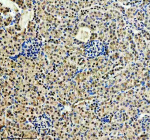 Immunohistochemical staining of CDK2(Phospho-T160)/CDK1(Phospho-T161) using anti-Phospho-CDK2/CDK1 (Thr160/Thr161) antibody. CDK2(Phospho-T160)/CDK1(Phospho-T161) was detected in a paraffin-embedded section of mouse kidney tissue. Heat mediated antigen retrieval was performed in EDTA buffer (pH 8.0, epitope retrieval solution). The tissue section was blocked with 10% goat serum. The tissue section was then incubated with a dilution of 1:50 rabbit anti-Phospho-CDK2/CDK1 (Thr160/Thr161) antibody overnight at 4oC. Peroxidase Conjugated Goat Anti-rabbit IgG was used as secondary antibody and incubated for 30 minutes at 37oC. The tissue section was developed using an HRP secondary and DAB substrate.