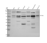 Western blot analysis of TRIM32 using anti-TRIM32 antibody. Electrophoresis was performed on a 10% SDS-PAGE gel at 80V (Stacking gel) / 120V (Resolving gel) for 2 hours. Lane 1: human Hela whole cell lysates, Lane 2: human PC-3 whole cell lysates, Lane 3: rat brain tissue lysates, Lane 4: rat PC-12 whole cell lysates, Lane 5: mouse brain tissue lysates, Lane 6: mouse Neuro-2a whole cell lysates. After electrophoresis, proteins were transferred to a nitrocellulose membrane at 150 mA for 50-90 minutes. Blocked the membrane with 5% non-fat milk/TBS for 1.5 hour at RT. The membrane was incubated with rabbit anti-TRIM32 antibody at 0.5 ug/ml overnight at 4oC, then washed with TBS-0.1%Tween 3 times with 5 minutes each and probed with a goat anti-rabbit IgG-HRP secondary antibody at a dilution of 1:5000 for 1.5 hour at RT. The signal was developed using an ECL Plus Western Blotting Substrate. A specific band was detected for TRIM32 at approximately 72 kDa. The expected molecular weight of TRIM32 is ~72 kDa.