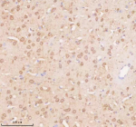 Immunohistochemical staining of TRIM32 using anti-TRIM32 antibody. TRIM32 was detected in a paraffin-embedded section of rat brain tissue. Heat mediated antigen retrieval was performed in EDTA buffer (pH 8.0, epitope retrieval solution). The tissue section was blocked with 10% goat serum. The tissue section was then incubated with 2 ug/ml rabbit anti-TRIM32 antibody overnight at 4oC. Peroxidase Conjugated Goat Anti-rabbit IgG was used as secondary antibody and incubated for 30 minutes at 37oC. The tissue section was developed using an HRP secondary and DAB substrate.