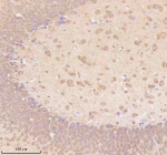 Immunohistochemical staining of TRIM32 using anti-TRIM32 antibody. TRIM32 was detected in a paraffin-embedded section of rat brain tissue. Heat mediated antigen retrieval was performed in EDTA buffer (pH 8.0, epitope retrieval solution). The tissue section was blocked with 10% goat serum. The tissue section was then incubated with 2 ug/ml rabbit anti-TRIM32 antibody overnight at 4oC. Peroxidase Conjugated Goat Anti-rabbit IgG was used as secondary antibody and incubated for 30 minutes at 37oC. The tissue section was developed using an HRP secondary and DAB substrate.