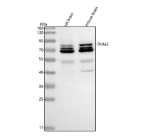 Western blot analysis of TRIM2 using anti-TRIM2 antibody. Lane 1: rat brain tissue lysates, Lane 2: mouse brain tissue lysates. After electrophoresis, proteins were transferred to a nitrocellulose membrane at 150 mA for 50-90 minutes. Blocked the membrane with 5% non-fat milk/TBS for 1.5 hour at RT. The membrane was incubated with rabbit anti-TRIM2 antibody at 0.5 ug/ml overnight at 4oC, then washed with TBS-0.1%Tween 3 times with 5 minutes each and probed with a goat anti-rabbit IgG-HRP secondary antibody at a dilution of 1:5000 for 1.5 hour at RT. The signal was developed using enhanced chemiluminescent. Western blot analysis of TRIM32 using anti-TRIM32 antibody. A major band is observed at ~72 kDa corresponding to full-length TRIM32, along with additional higher- and lower-molecular-weight species consistent with reported post-translationally modified and processed forms of the protein.