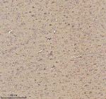 Immunohistochemical staining of TRIM2 using anti-TRIM2 antibody. TRIM2 was detected in a paraffin-embedded section of rat brain tissue. Heat mediated antigen retrieval was performed in EDTA buffer (pH 8.0, epitope retrieval solution). The tissue section was blocked with 10% goat serum. The tissue section was then incubated with 2 ug/ml rabbit anti-TRIM2 antibody overnight at 4oC. Peroxidase Conjugated Goat Anti-rabbit IgG was used as secondary antibody and incubated for 30 minutes at 37oC. The tissue section was developed using an HRP secondary and DAB substrate.