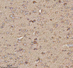Immunohistochemical staining of TRIM2 using anti-TRIM2 antibody. TRIM2 was detected in a paraffin-embedded section of rat brain tissue. Heat mediated antigen retrieval was performed in EDTA buffer (pH 8.0, epitope retrieval solution). The tissue section was blocked with 10% goat serum. The tissue section was then incubated with 2 ug/ml rabbit anti-TRIM2 antibody overnight at 4oC. Peroxidase Conjugated Goat Anti-rabbit IgG was used as secondary antibody and incubated for 30 minutes at 37oC. The tissue section was developed using an HRP secondary and DAB substrate.