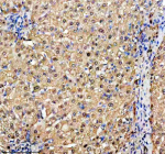 Immunohistochemical staining of TKFC using anti-TKFC antibody. TKFC was detected in a paraffin-embedded section of human liver tissue. Heat mediated antigen retrieval was performed in EDTA buffer (pH 8.0, epitope retrieval solution). The tissue section was blocked with 10% goat serum. The tissue section was then incubated with 2 ug/ml rabbit anti-TKFC antibody overnight at 4oC. Peroxidase Conjugated Goat Anti-rabbit IgG was used as secondary antibody and incubated for 30 minutes at 37oC. The tissue section was developed using an HRP secondary and DAB substrate.