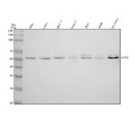 Western blot analysis of ACP2 using anti-ACP2 antibody. Lane 1: human Hela whole cell lysates, Lane 2: human U251 whole cell lysates, Lane 3: human MCF-7 whole cell lysates, Lane 4: human Caco-2 whole cell lysates, Lane 5: human 293T whole cell lysates, Lane 6: human whole cell lysates, Lane 7: human SH-SY5Y whole cell lysates. After electrophoresis, proteins were transferred to a nitrocellulose membrane at 150 mA for 50-90 minutes. Blocked the membrane with 5% non-fat milk/TBS for 1.5 hour at RT. The membrane was incubated with rabbit anti-ACP2 antibody at 0.5 ug/ml overnight at 4oC, then washed with TBS-0.1%Tween 3 times with 5 minutes each and probed with a goat anti-rabbit IgG-HRP secondary antibody at a dilution of 1:5000 for 1.5 hour at RT. The signal was developed using enhanced chemiluminescent. The expected molecular weight of ACP2 is at 48,18 kDa.