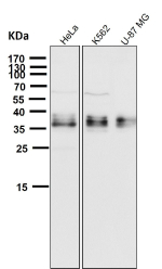 All lanes use the GGH antibody at 1:1000 dilution for 1 hour at room temperature. Western blot analysis of GGH using anti-GGH antibody. A principal band is observed at ~36 kDa with additional closely migrating bands, consistent with reported glycosylated and proteolytically processed forms of GGH.