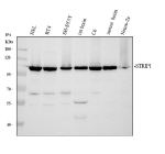 Western blot analysis of STRIP1 using anti-STRIP1 antibody. Electrophoresis was performed on a 8% SDS-PAGE gel at 80V (Stacking gel) / 120V (Resolving gel) for 2 hours. Lane 1: human HEL whole cell lysates, Lane 2: human RT4 whole cell lysates, Lane 3: human SH-SY5Y whole cell lysates, Lane 4: rat brain tissue lysates, Lane 5: rat C6 whole cell lysates, Lane 6: mouse brain tissue lysates, Lane 7: mouse Neuro-2a whole cell lysates. After electrophoresis, proteins were transferred to a nitrocellulose membrane at 150 mA for 50-90 minutes. Blocked the membrane with 5% non-fat milk/TBS for 1.5 hour at RT. The membrane was incubated with rabbit anti-STRIP1 antibody at 0.5 ug/ml overnight at 4oC, then washed with TBS-0.1%Tween 3 times with 5 minutes each and probed with a goat anti-rabbit IgG-HRP secondary antibody at a dilution of 1:5000 for 1.5 hour at RT. The signal is developed using an ECL Plus Western Blotting Substratewith Tanon 5200 system. The expected molecular weight of STRIP1 is ~96 kDa.