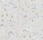 Immunohistochemical staining of STRIP1 using anti-STRIP1 antibody. STRIP1 was detected in a paraffin-embedded section of human brain tissue. Heat mediated antigen retrieval was performed in EDTA buffer (pH 8.0, epitope retrieval solution). The tissue section was blocked with 10% goat serum. The tissue section was then incubated with 2 ug/ml rabbit anti-STRIP1 antibody overnight at 4oC. Peroxidase Conjugated Goat Anti-rabbit IgG was used as secondary antibody and incubated for 30 minutes at 37oC. The tissue section was developed using an HRP secondary and DAB substrate.